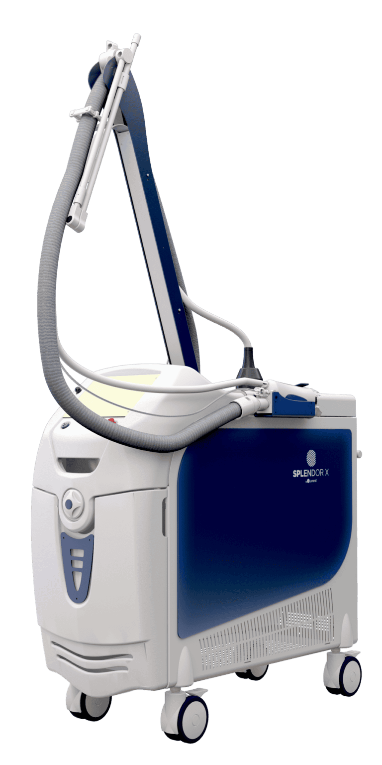 Splendor X Laser Machine