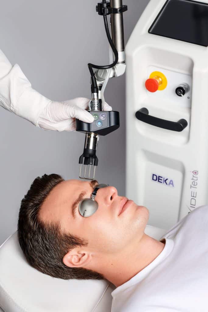 NeoGen Plasma vs CO2 Laser