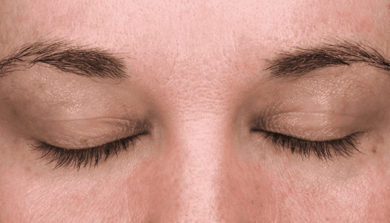 NeoGen Plasma Treatment