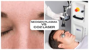 NeoGen Plasma vs CO2 Laser
