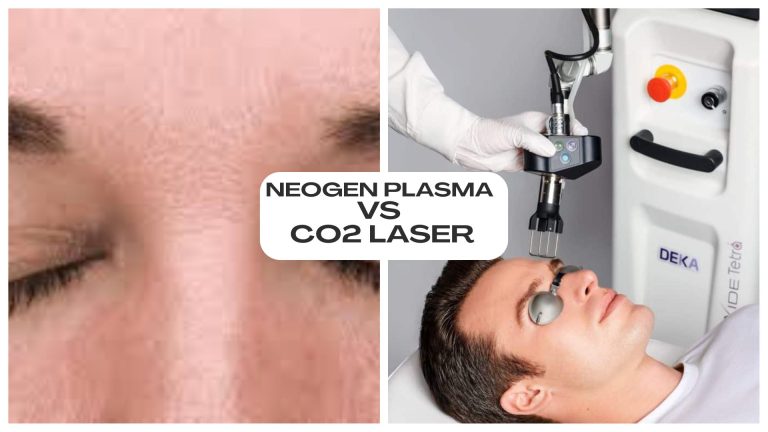NeoGen Plasma vs CO2 Laser