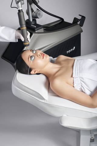 Pico Photofacial Treatment
