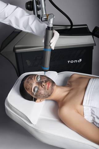 Carbon Laser Peel and Thermal Laser